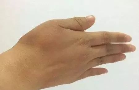 每天這樣拍手100次 ，彌補久坐傷害，快來給內臟按按摩